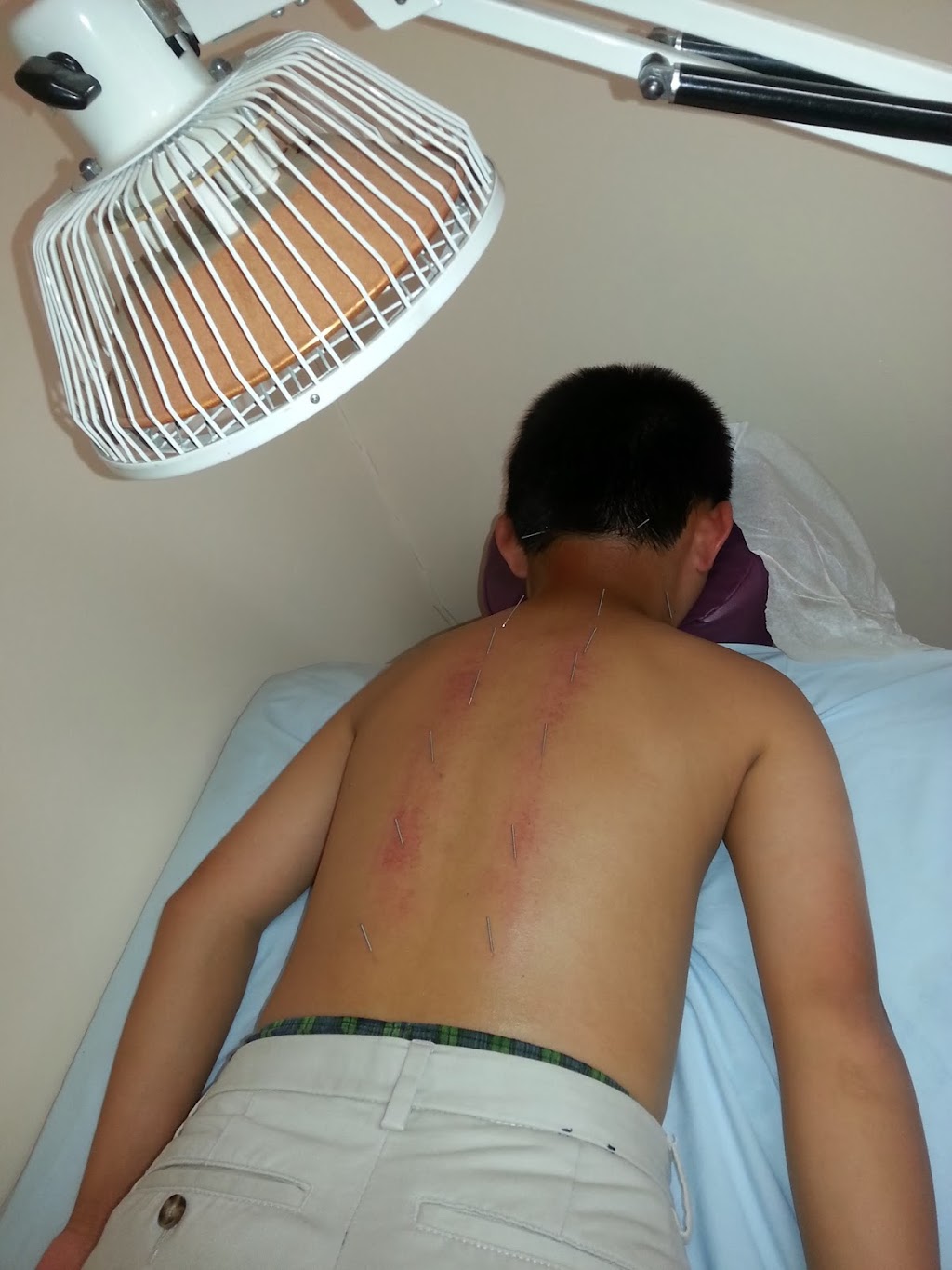 Reishi Acupuncture Clinic | 419 W Las Tunas Dr, San Gabriel, CA 91776, USA | Phone: (626) 382-6607 Reishi Acupuncture Clinic | 419 W Las Tunas Dr, San Gabriel, CA 91776, USA | Phone: (626) 382-6607