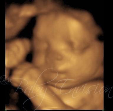 Baby Envision 4D Ultrasound of Troy | 650 E Big Beaver Rd e, Troy, MI 48083, USA | Phone: (810) 229-9899