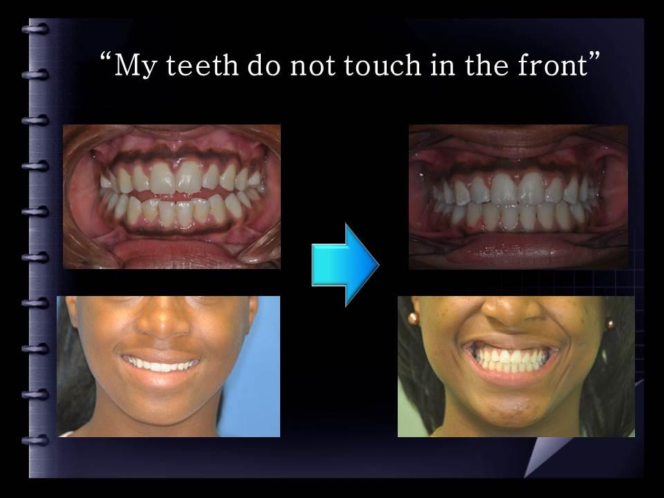 Grand Avenue Dental | 734 N Grand Ave, Gainesville, TX 76240, USA | Phone: (940) 668-9000