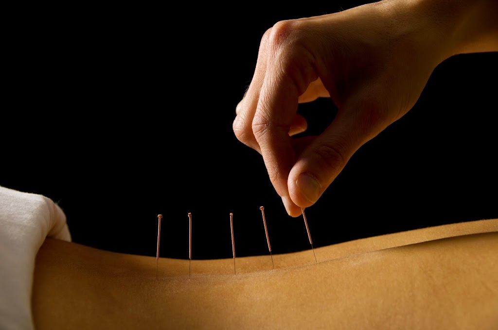 Tricia L. Mattson L.Ac - TCM Acupuncture Canon City, CO | 2800 N 9th St C-1, Cañon City, CO 81212, USA | Phone: (719) 345-7110