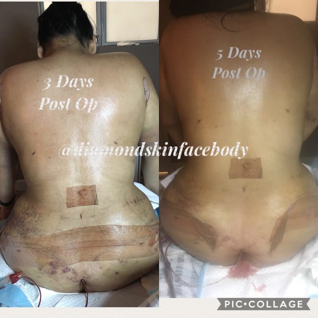 Diamond Beauty Care | 11836 Downey Ave UNIT 105, Downey, CA 90241, USA | Phone: (562) 261-7510