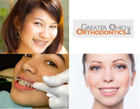 Greater Ohio Orthodontics | 8509 Owenfield Dr, Powell, OH 43065, USA | Phone: (614) 398-8197