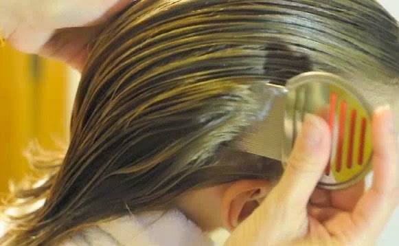 Tiny Locks Lice Treatment Orange County | 334 Morse Ave, Placentia, CA 92870, USA | Phone: (949) 207-3433