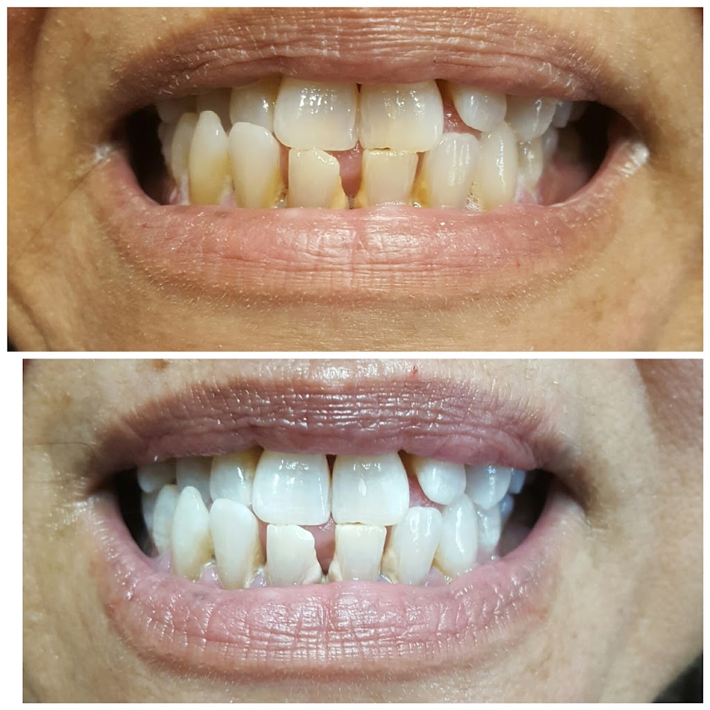 New Smiles Teeth Whitening | 222 Grifford Dr, Kissimmee, FL 34758, USA | Phone: (407) 279-0490
