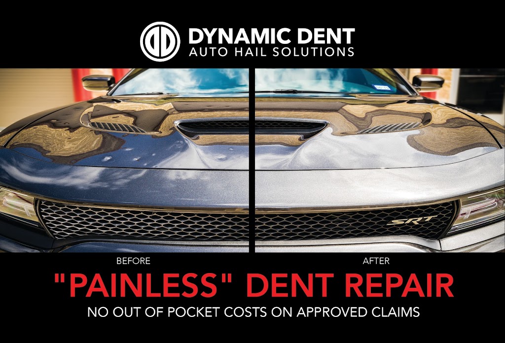 Dynamic Dent Removal | 985 TX-121 suite 623, Lewisville, TX 75057, USA | Phone: (972) 219-0440