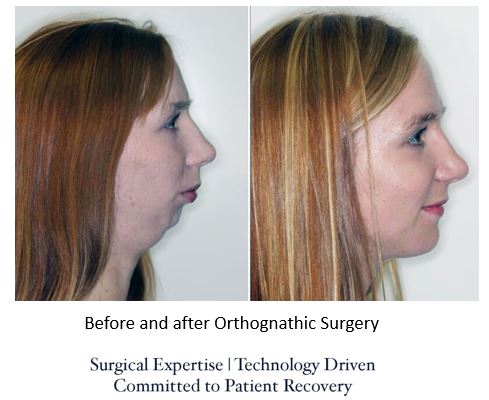 About Face Surgical Arts: Khurram A. Khan BDS, DMD | 7523 State Rd, Cincinnati, OH 45255, USA | Phone: (513) 232-8989