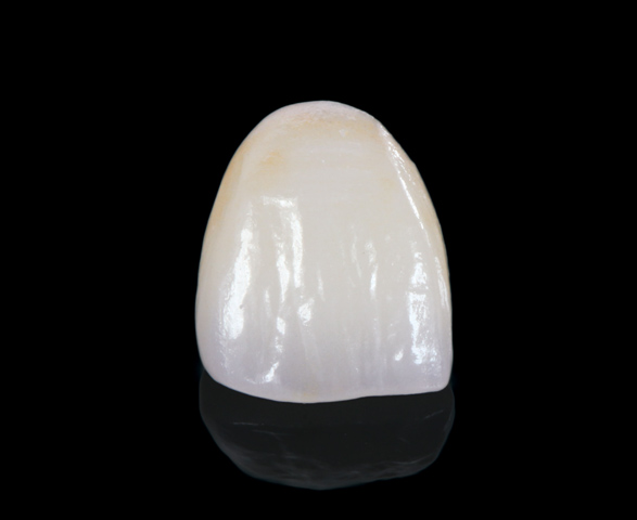 MicroDental Las Vegas Laboratory | 1401 Hillshire Dr # 110, Las Vegas, NV 89134, USA | Phone: (702) 458-1079