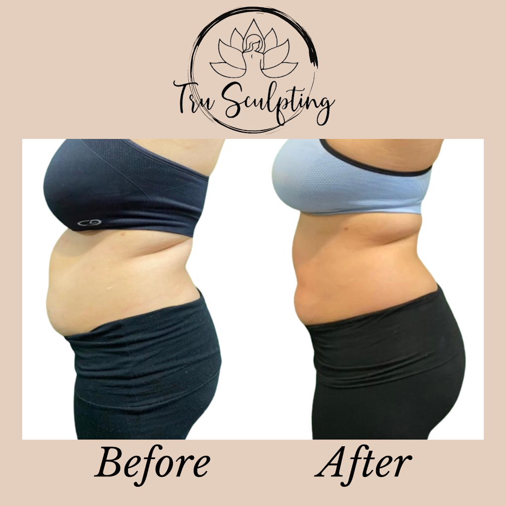 Tru Sculpting Health & Beauty | 2201 E Willow St # H, Signal Hill, CA 90755, USA | Phone: (562) 481-4392 Tru Sculpting Health & Beauty | 2201 E Willow St # H, Signal Hill, CA 90755, USA | Phone: (562) 481-4392