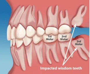 Osseo Family Dental | 30 Central Ave, Osseo, MN 55369, United States | Phone: (763) 425-2626