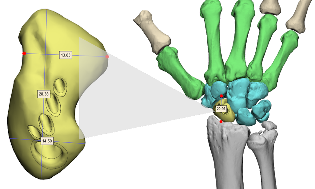 TECHFIT Digital Surgery | 1511 Aviation Center Pkwy Suite 220H, Daytona Beach, FL 32114, USA | Phone: (386) 872-0872