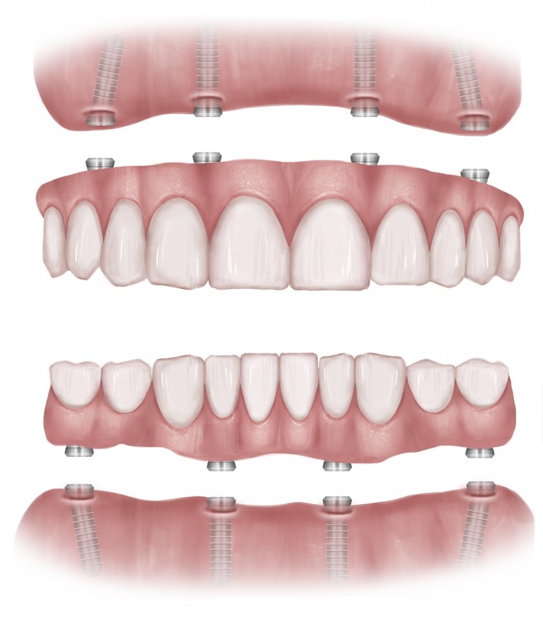 Ellicott City Smiles Dental Group | 10132 Baltimore National Pike suite c, Ellicott City, MD 21042, USA | Phone: (410) 465-3224