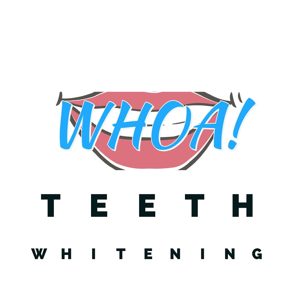 Whoa Whitening Teeth Whitening | 2187 Sharon Rd, Cumming, GA 30041, USA | Phone: (470) 495-6059