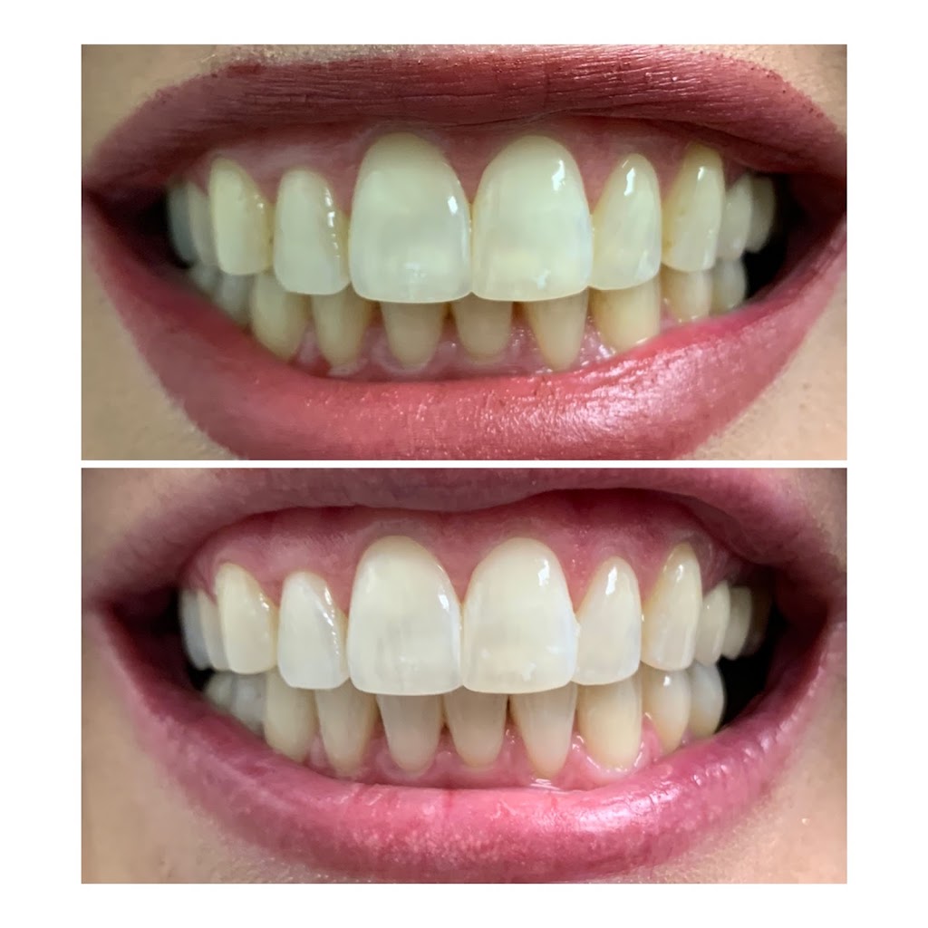 Smile Spa Teeth Whitening | 143 E Germann Rd building 101 suite 404, Gilbert, AZ 85297, USA | Phone: (480) 925-4050