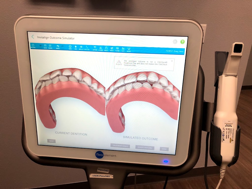 Smileasy Dental & Orthodontics inside Walmart | 425 Coit Rd #400, Plano, TX 75075, USA | Phone: (972) 499-7733