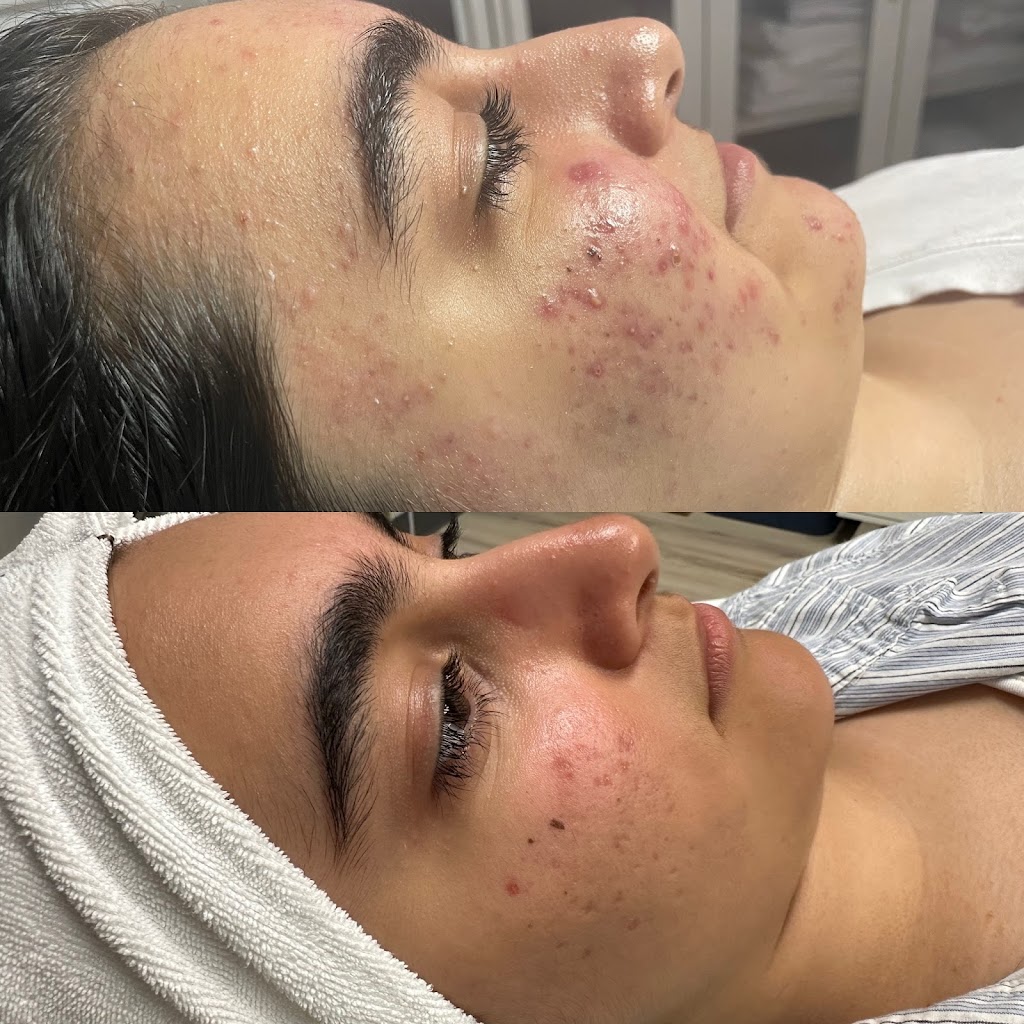 Strickly Skin Esthetics | 105 E Oak St Ste. 101, Mansfield, TX 76063, USA | Phone: (817) 320-8485