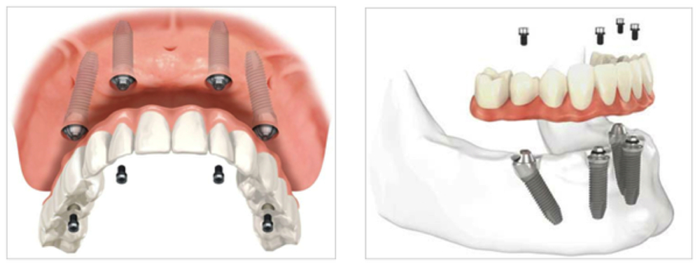 Sharda Family Dentistry - Dentists in Creedmoor NC | 2552 Capitol Dr Ste 101, Creedmoor, NC 27522, USA | Phone: (919) 528-9500