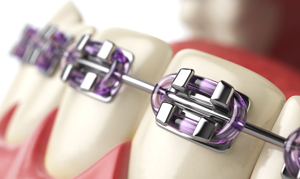 Dentronix Orthodontic Tools & Supplies | 235 Ascot Pkwy, Cuyahoga Falls, OH 44223, USA | Phone: (800) 221-3046