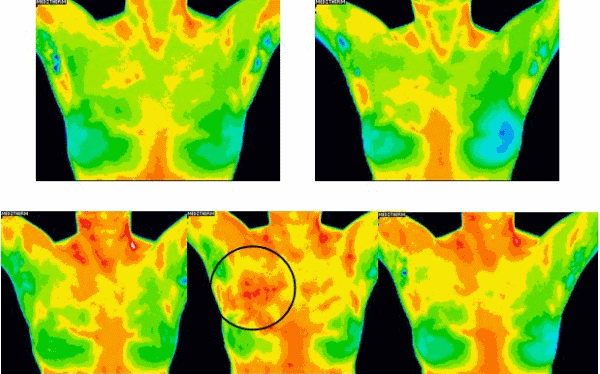 SoCal Medical Thermography | 1015 Chestnut Ave STE B3, Carlsbad, CA 92008, USA | Phone: (760) 519-0038