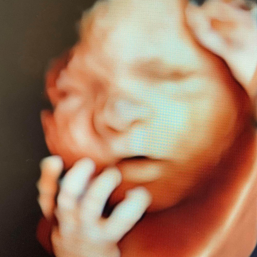 Baby Bloom 4D Ultrasound Studio | 11481 Old St Augustine Rd STE 302, Jacksonville, FL 32258, USA | Phone: (904) 460-3756