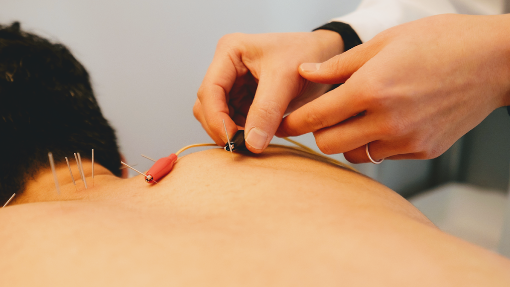 Grace Acupuncture | 930 Susquehanna Rd, Ambler, PA 19002 | Phone: (267) 957-4073