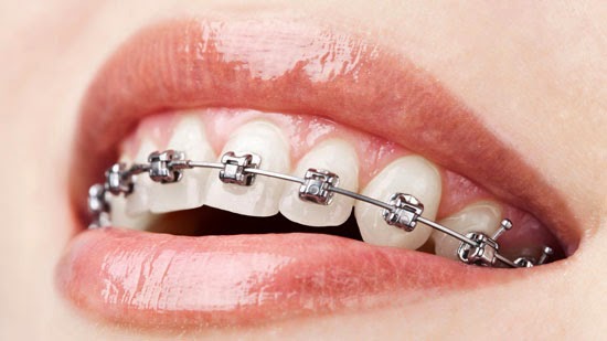 Ahrens Orthodontics- Crestwood | 6225 KY-146, Crestwood, KY 40014, USA | Phone: (502) 241-1811