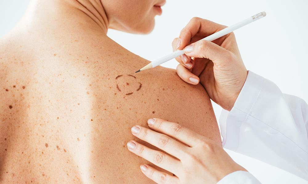 Cleaver Medical Group Dermatology | 105 Professional Park Dr, Cumming, GA 30040, USA | Phone: (770) 800-3455