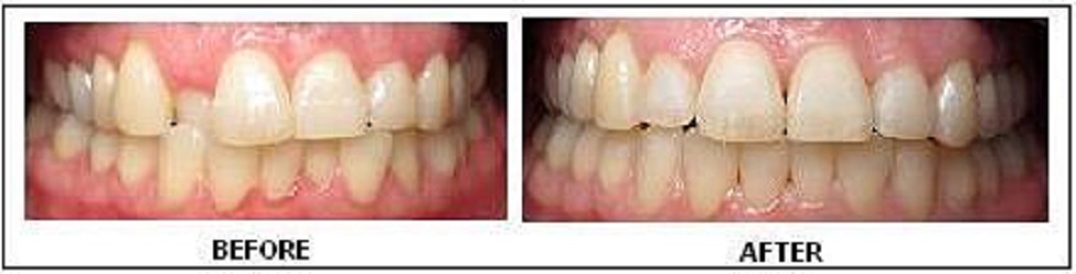 ProSmile Dentistry: Parisa Zarbafian DDS | 26720 Towne Centre Dr A, Foothill Ranch, CA 92610, USA | Phone: (949) 583-1500