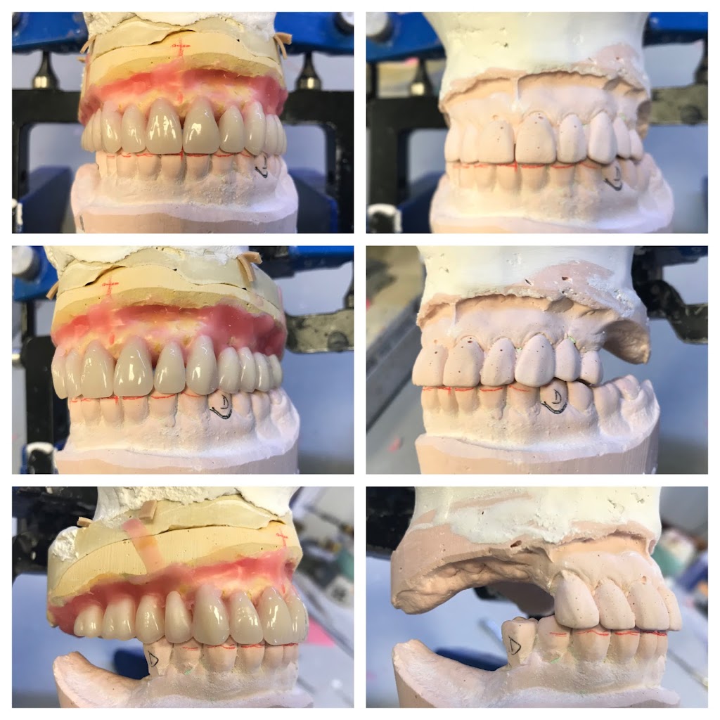 Precision Dental Prosthetics | 23021 N 15th Ave #205, Phoenix, AZ 85027, USA | Phone: (602) 485-7845