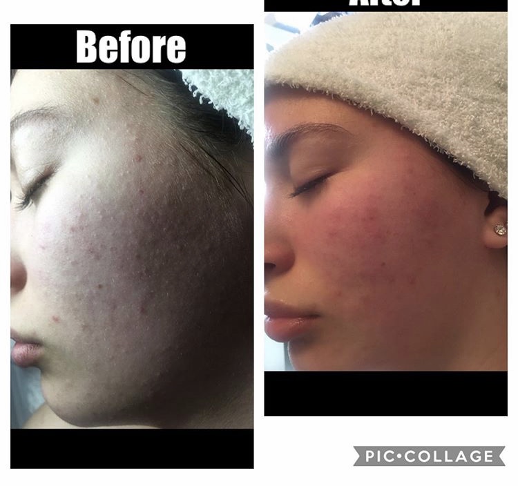 Skin Care by Anna | 12410 Burbank Blvd # 103, Valley Village, CA 91607, USA | Phone: (818) 414-7151