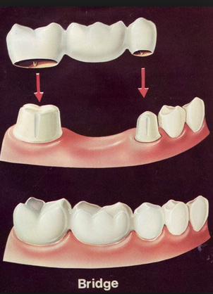 Gentle Dental: Emil Sedrakyan DDS | 1003 North Point Blvd #602, Baltimore, MD 21224, USA | Phone: (410) 282-8313