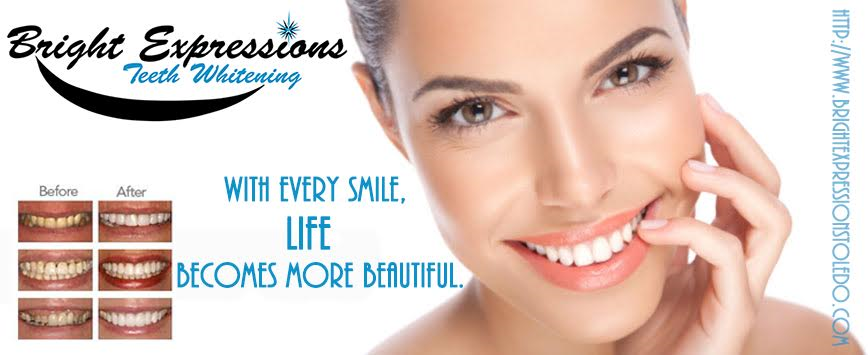 Bright Expressions Teeth Whitening | 4334 Central Ave #231, Toledo, OH 43615, USA | Phone: (419) 410-6062
