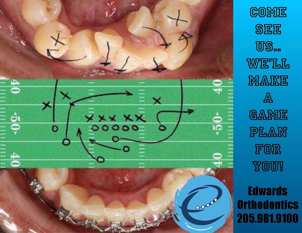 Edwards Orthodontics | 1063 Narrows Way, Birmingham, AL 35043, USA | Phone: (205) 981-9100