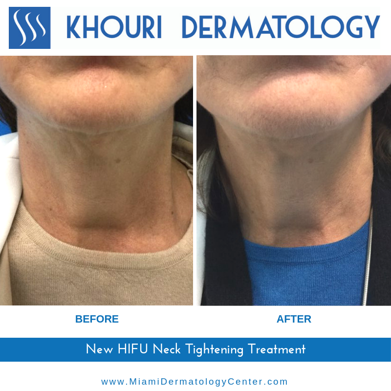 Khouri Dermatology | 103400 Overseas Hwy #237, Key Largo, FL 33037, USA | Phone: (305) 361-8200