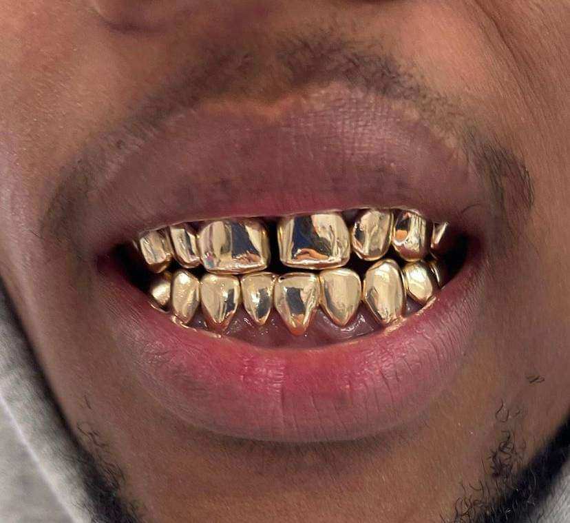 Gold Grillz & Jewelry, Gold2Ink LLC | 1503 NW 47th Ave, Lauderhill, FL 33313, USA | Phone: (979) 291-8055
