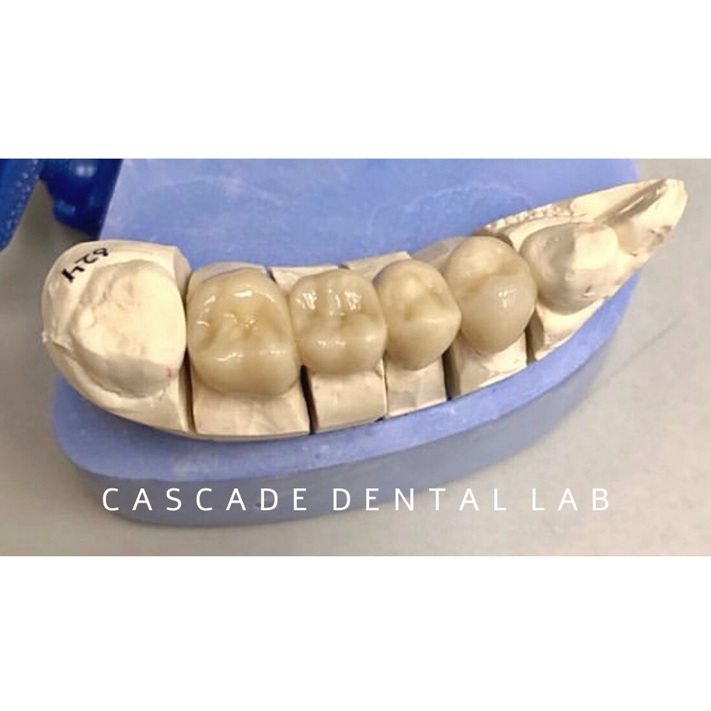 Cascade Dental Laboratory Inc | 1346 8th St NE, Auburn, WA 98002, USA | Phone: (253) 939-3540