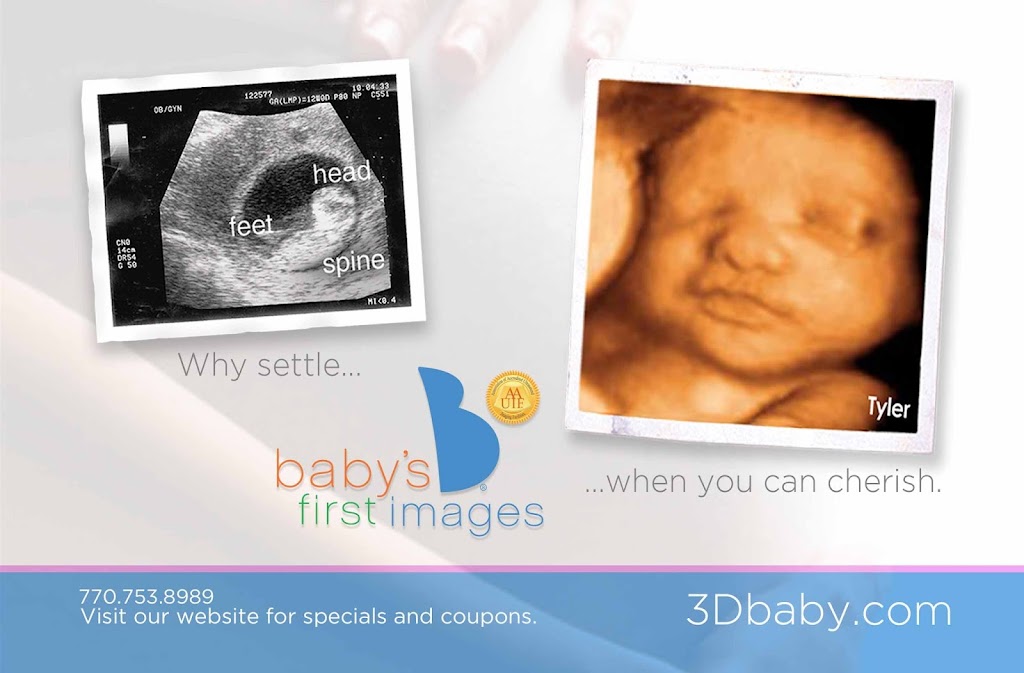 Babys First Images Ultrasound | 1275 Shiloh Rd NW #2730, Kennesaw, GA 30144, USA | Phone: (770) 753-8989