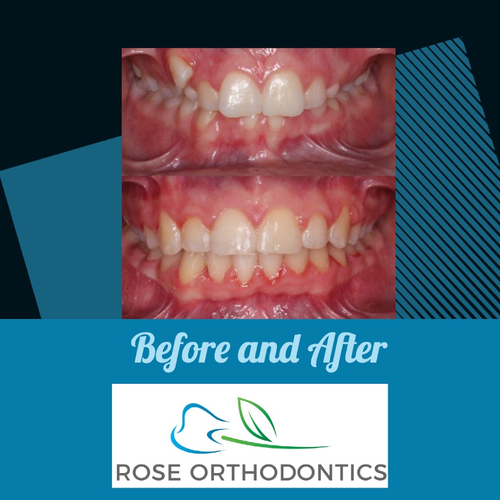 Rose Orthodontics: Aaron Rose, DMD, MS | 980 W Central Ave Suite D, Delaware, OH 43015 | Phone: (740) 272-4455