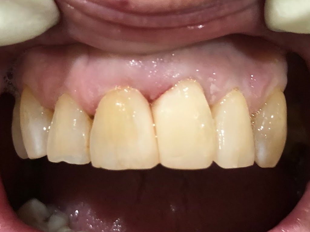 American Dental and Implant Center | 3492 E Rosemeade Pkwy, Carrollton, TX 75007, USA | Phone: (972) 241-4433