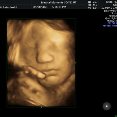 Magical Moments 3D/4D Ultrasounds | 20304 W Valley Blvd, Tehachapi, CA 93561, USA | Phone: (661) 972-4473