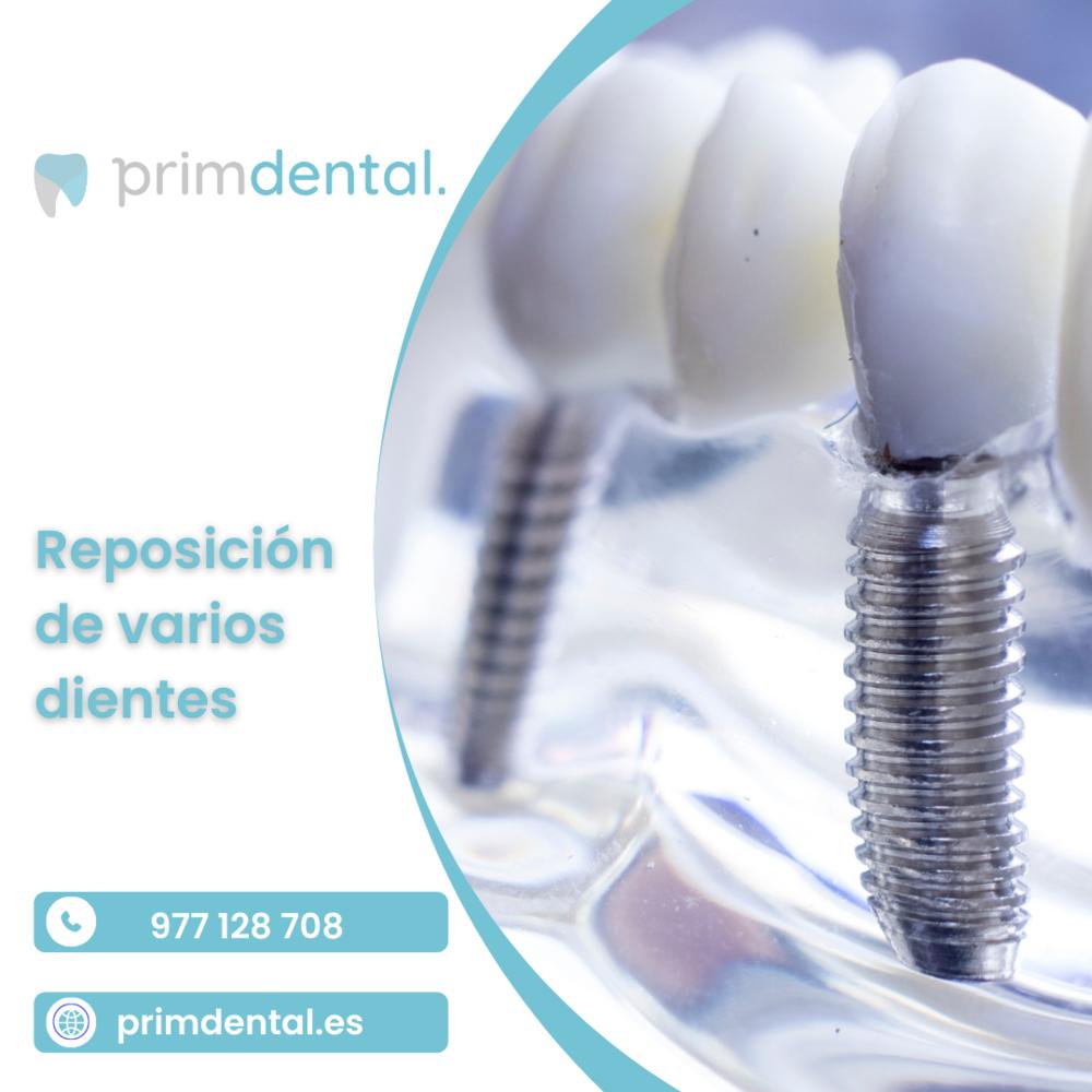 Primdental - Clínica Dental Reus | Raval de Martí Folguera, 22, 43201 baix, Tarragona, Spain | Phone: 0977 12 87 08