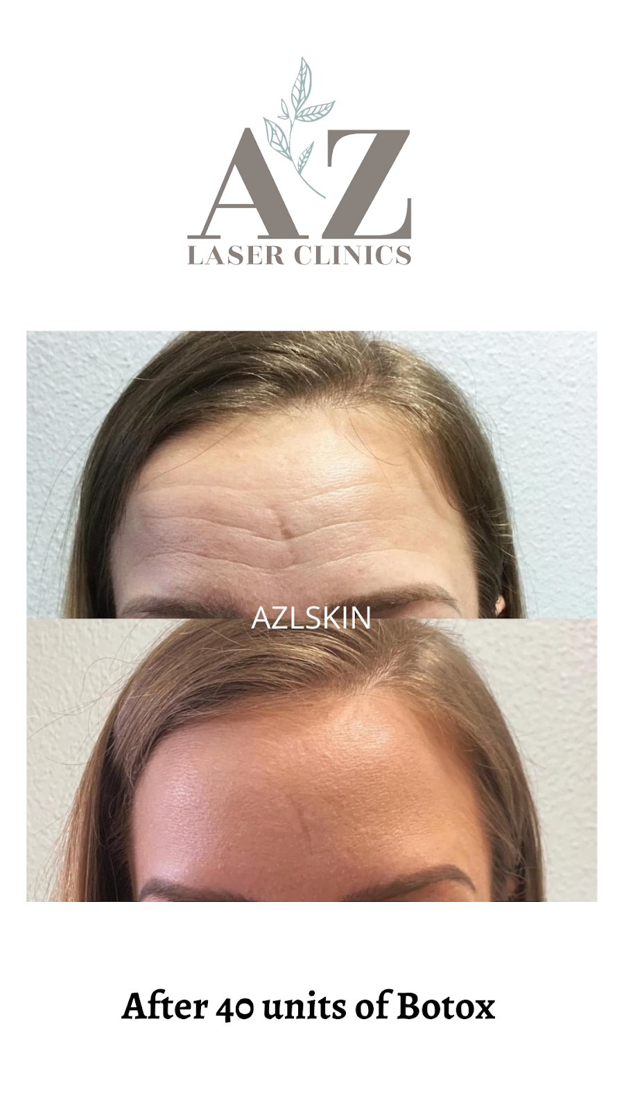 AZ Laser Clinics | 5702 W Glendale Ave, Glendale, AZ 85301, USA | Phone: (623) 937-8969