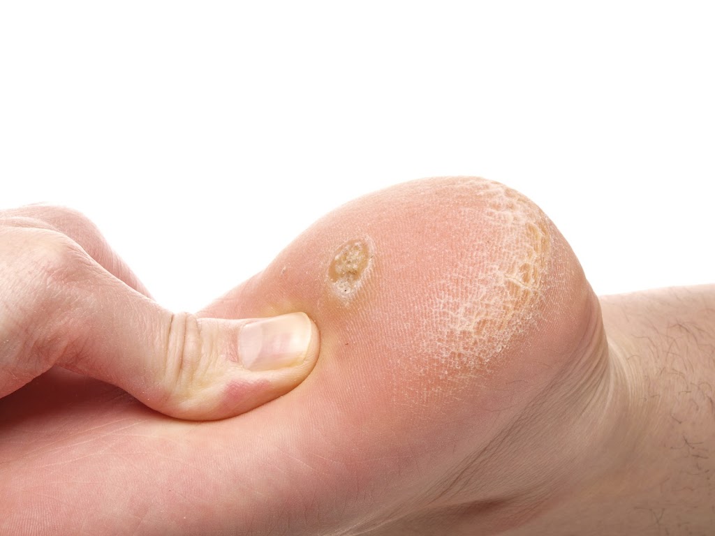 Ambridge Podiatry Associates | 447 Maplewood Ave, Ambridge, PA 15003 | Phone: (878) 313-3338