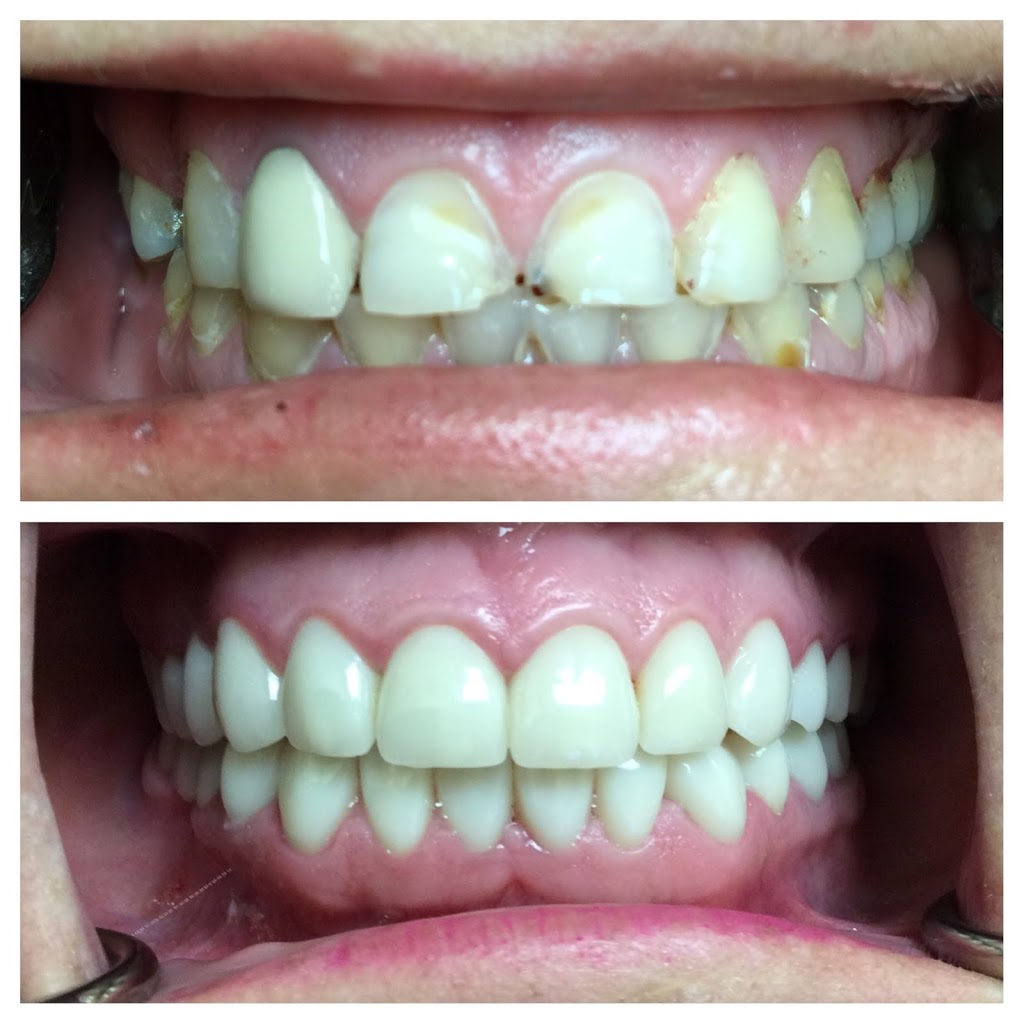 All Smiles Dentistry - Dr. Sheyda Zahiri | 4130 N 108th Ave suite101, Phoenix, AZ 85037, USA | Phone: (623) 535-9164