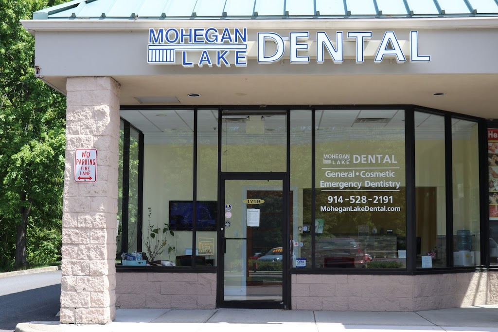 Mohegan Lake Dental PC | 1719 E Main St, Mohegan Lake, NY 10547, USA | Phone: (914) 528-2191