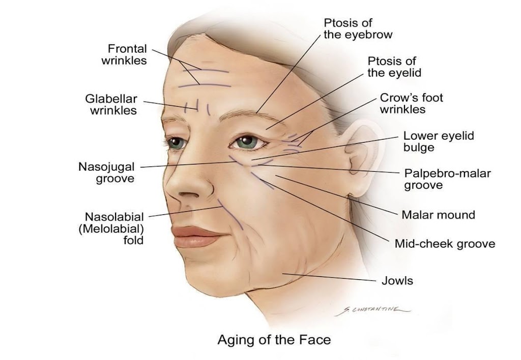 Aurelia medical center Clínica de verrugas I Lunares I kiloids | 2545 Hempstead Tpke, East Meadow, NY 11554, USA | Phone: (516) 503-7058