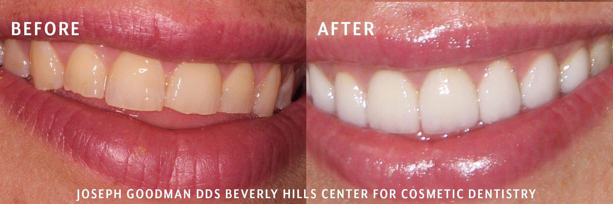 Dr. Joseph Goodman | Beverly Hills Dentist | 241 1/2 S Beverly Dr Suite 201, Beverly Hills, CA 90212, United States | Phone: (310) 860-9311