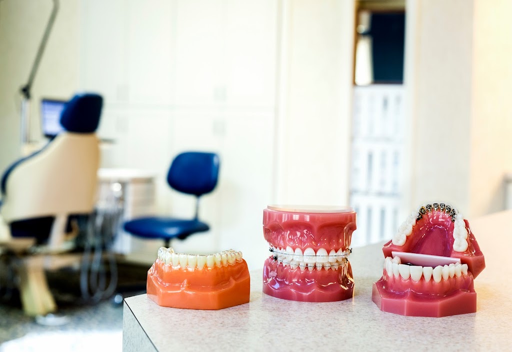 Depew Orthodontics | 2748 Watts Dr, Kennesaw, GA 30144, USA | Phone: (770) 422-3939