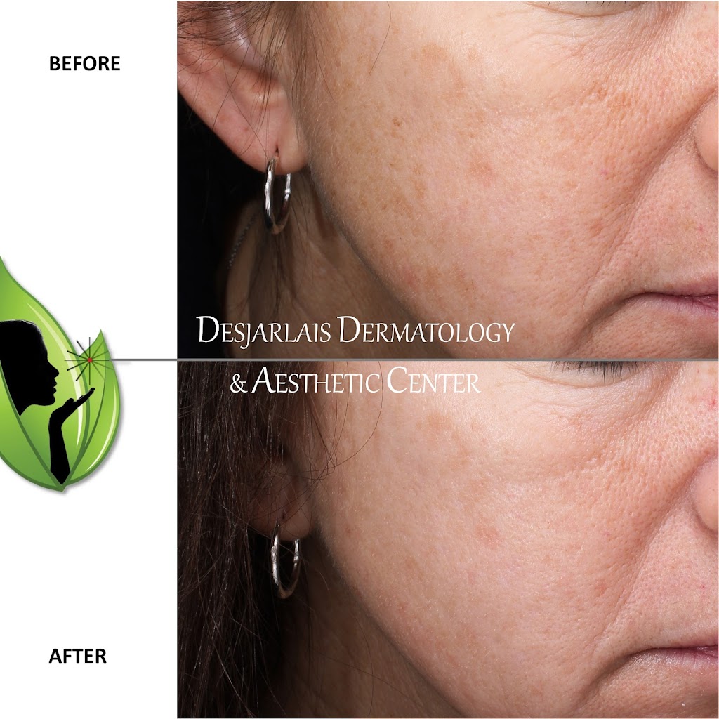 Desjarlais Dermatology & Aesthetic Center | 2000 Curtis Rd, Adrian, MI 49221, USA | Phone: (517) 264-5603