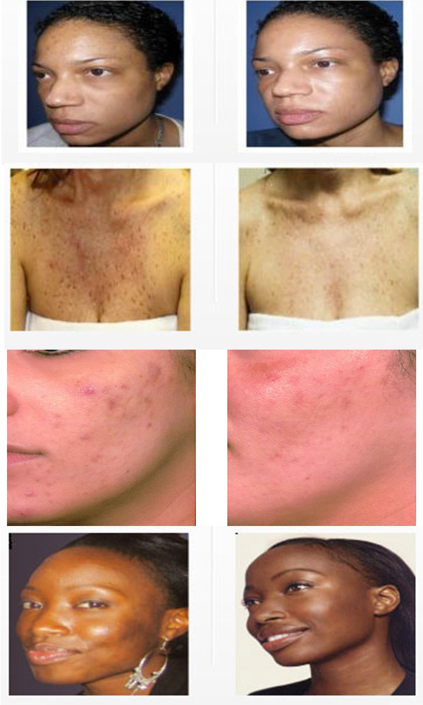 Angels Skin Care | 5919 Farralone Ave, Woodland Hills, CA 91367, USA | Phone: (818) 489-6613