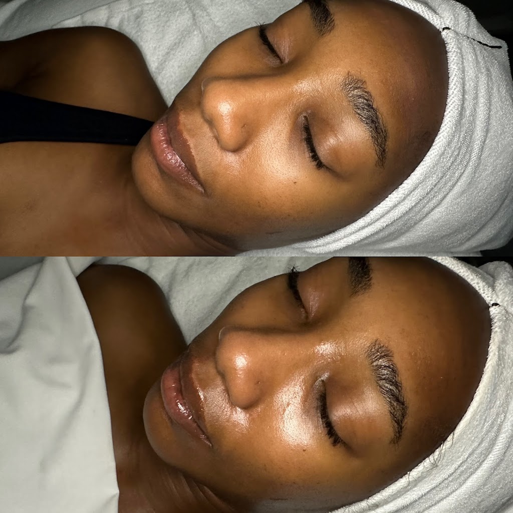 Strickly Skin Esthetics | 105 E Oak St Ste. 101, Mansfield, TX 76063, USA | Phone: (817) 320-8485